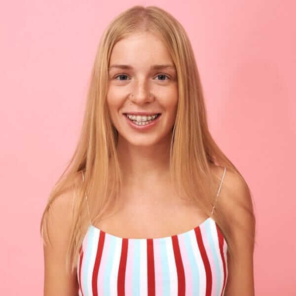 Şeffaf Braketler (Estetik Diş Teli Tedavisi)