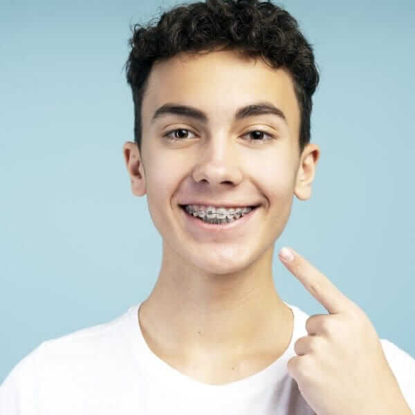 Metal Braketler (Diş Teli Tedavisi)